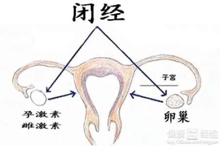 闭经吃什么药能快来经 什么是闭经