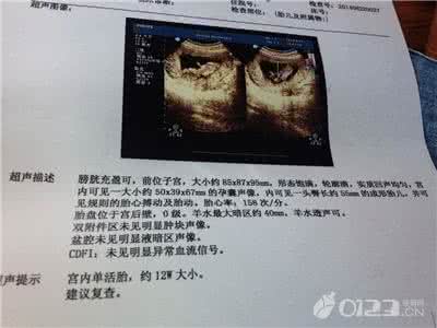 怀孕初期可以做b超吗 怀孕多久可以做b超?