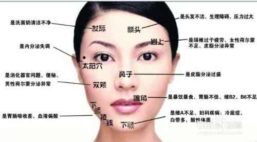 下巴长痘痘是什么原因 下巴长痘痘的原理和解决方法
