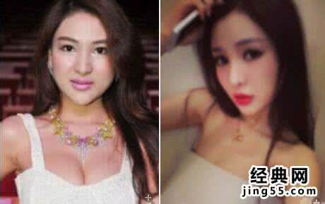 郭美美整容前照片对比 郭美美真实照片整容前 郭美美整容前照片