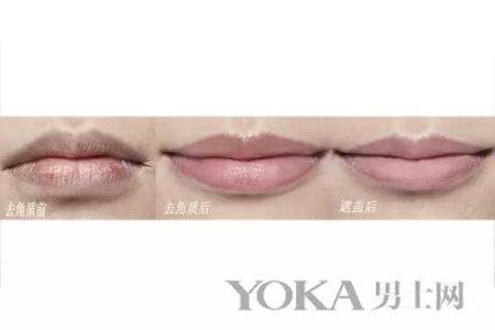 嘴唇干燥缺什么维生素 冬季嘴唇干燥脱皮 妙用维生素！