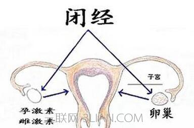 闭经怎么办我才22岁 闭经是怎么回事