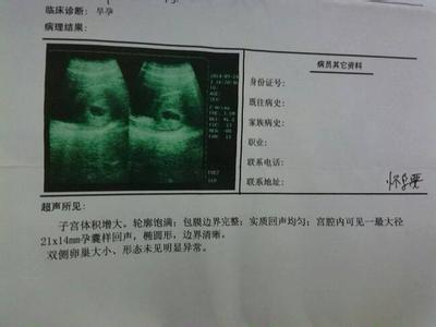 第一次b超算预产期准吗 B超预产期准吗