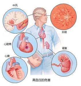 总胆固醇偏高的原因 胆固醇高的原因 总胆固醇高是怎么回事，后果？吃什么?_胆固醇高的原因