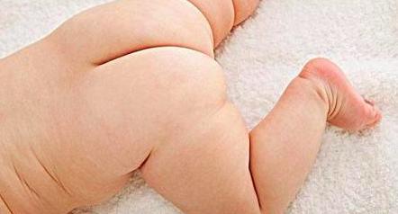 尿布疹护理 宝宝尿布疹怎么办 宝宝尿布疹如何预防和护理？