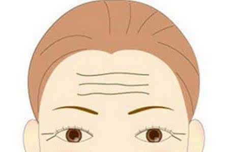 如何去除抬头纹妙招 怎样减少抬头纹 制止无意识皱眉减少抬头纹