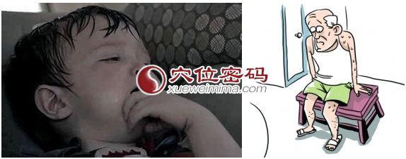 夜间盗汗 点揉两个穴位 巧治夜间盗汗、肾阴虚