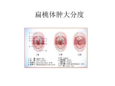 甲状腺肿大分度标准 甲状腺肿大分度 分度的标准是什么