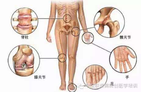 中医骨病基础知识 骨病基础知识