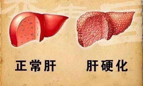 三个月孕妇瑜伽动作 一个动作坚持二、三个月, 就可以改善体质、精力倍增