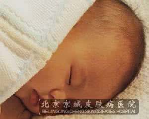 常见皮肤病图片大全 7大常见皮肤病 如何预防