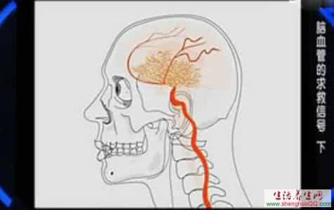 健康之路肝不好有信号 【健康之路】脑血管的求救信号（下）