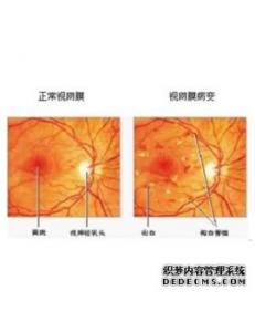 视网膜屏幕是什么意思 视网膜屏 视网膜屏是什么意思