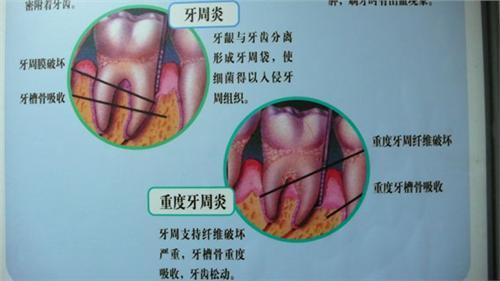 牙病的种类和治疗 【转载】治疗牙痛,牙病的100多种方法大集合