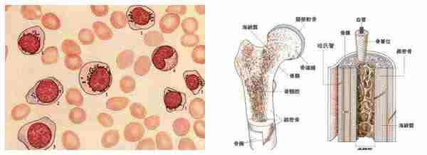 骨髓增生异常综合症 骨髓增生异常综合症 骨髓增生异常病因
