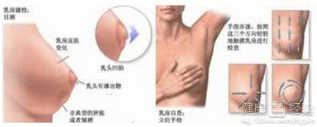 乳腺增生的检查方法 乳腺增生的检查方法 怎样和其他疾病鉴别