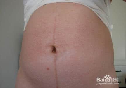 肚脐眼很脏怎么清洗 肚脐眼怎么清洗 肚脐眼有脏东西怎么清洗