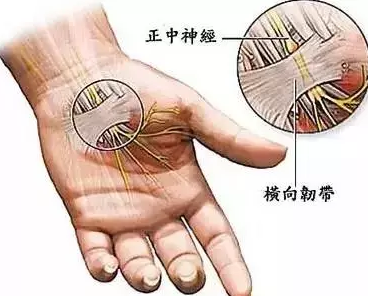 影响燃烧现象的因素 手部出现麻木现象居然与这几个因素有关