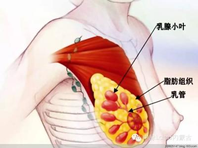 乳腺增生和乳腺癌 远离乳腺癌 远离乳腺增生 你需要做好这7点