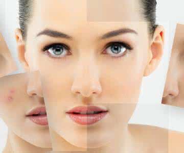 祛斑最有效的方法白醋 白醋真的能祛斑吗 有效吗