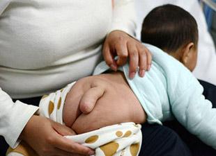 脑溢血昏迷多久能醒 脑溢血昏迷多久能醒 脑溢血昏迷 脑溢血的症状表现有哪些