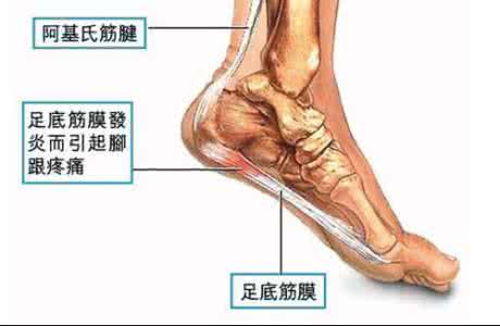 筋膜炎症状表现 筋膜炎的症状 这三种表现为主!