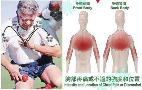 胸痹心痛 反复验证过的胸痹心痛方