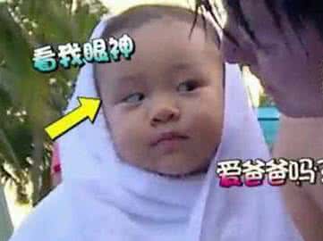 小孩辫子的简易扎法 小孩斜视简易测试法