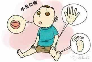 手足口病高发期 手足口病高发6岁以下儿童要小心 妈妈们更要当心