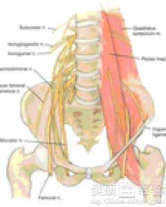 治坐骨神经痛特效秘方 坐骨神经痛特效方