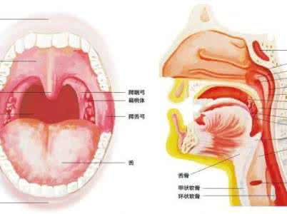 咽喉炎最佳治疗方法 咽喉炎治疗 多种方法治咽喉炎