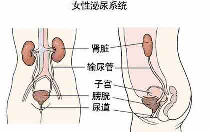 女性尿路感染的原因 女性尿路感染 女性尿路感染是什么原因