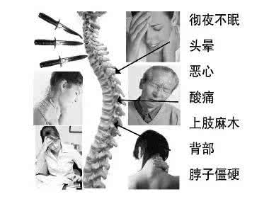 颈椎酸痛能让耳鸣吗 几个小技巧让你的颈椎不再痛
