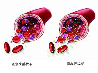 青岛内分泌糖尿病医院 2012年内分泌与糖尿病学国内外指南一览