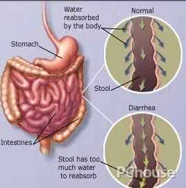 婴儿肚子胀气的原因 肚子胀气 “气”到底从哪来原因多