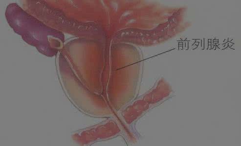 炒葱白敷肚脐驱寒 葱白贴敷肚脐，大、小便真的很方便！