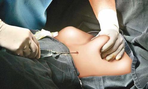 专业注射隆胸取出 注射隆胸 专业隆胸