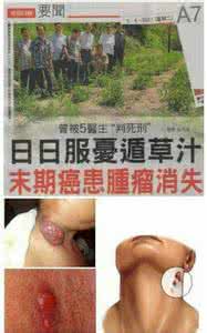 奇迹癌症居然消失了 每天吃忧遁草汁末期癌症消失了「忧遁草」複方