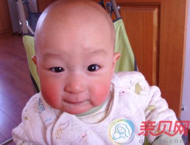 宝宝小脸通红 给宝宝洗了那么多次小脸，您真的会洗吗？