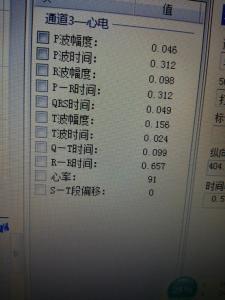 心电图数据怎么看 心电图检查数据如何看？