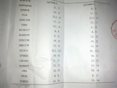 dna亲子鉴定收费 dna亲子鉴定 DNA亲子鉴定知识