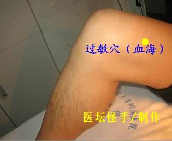 治疗皮肤瘙痒的药 治疗皮肤瘙痒的穴位 牛皮癣的穴位治疗