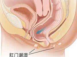 蛲虫病的症状 蛲虫病症状 外阴蛲虫病的检查及症状