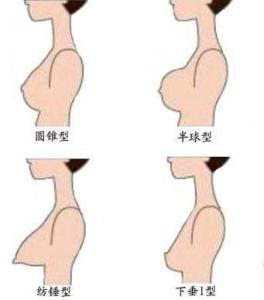 20女孩乳房发育图片 少女各个时期乳房发育全过程