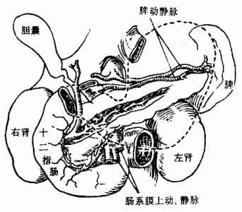 胆石症治疗方法 龚士澄治胆石症六方