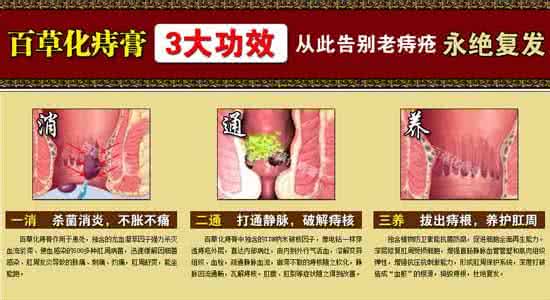 女性治痔疮的根治办法 连服十二剂,痔疮永根治