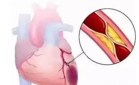 心脏刺痛是什么征兆 心脏有问题时会出现的11个征兆