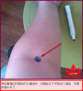 喝一碗垫底的酒 产后喝一碗红参汤 每天喝一碗连续几个星期，白发就这样一根都没有了