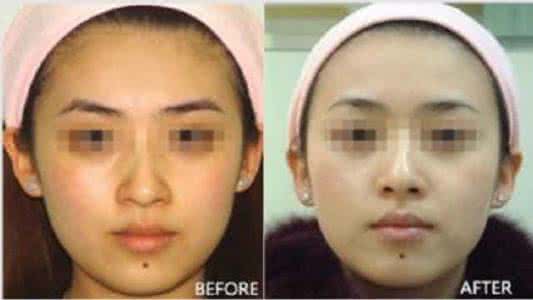 吃什么可以淡化黑色素 吃什么可以淡化黑色素 洗脸加它，没想到会有这效果，能快够速淡化黑色素