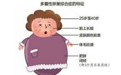多囊卵巢综合症怀孕 多囊卵巢综合症能怀孕吗 患上它有什么症状